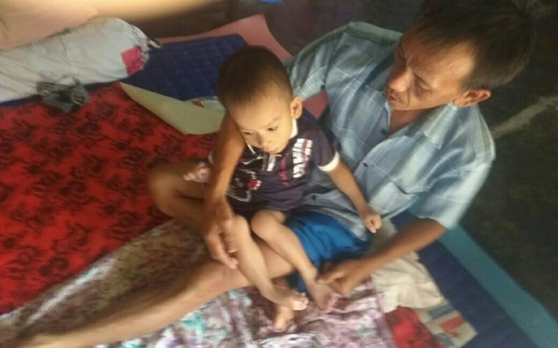  Usia 5 Tahun, Zuril Warga Kecamatan Limau Tanggamus Hanya Bisa Berbaring