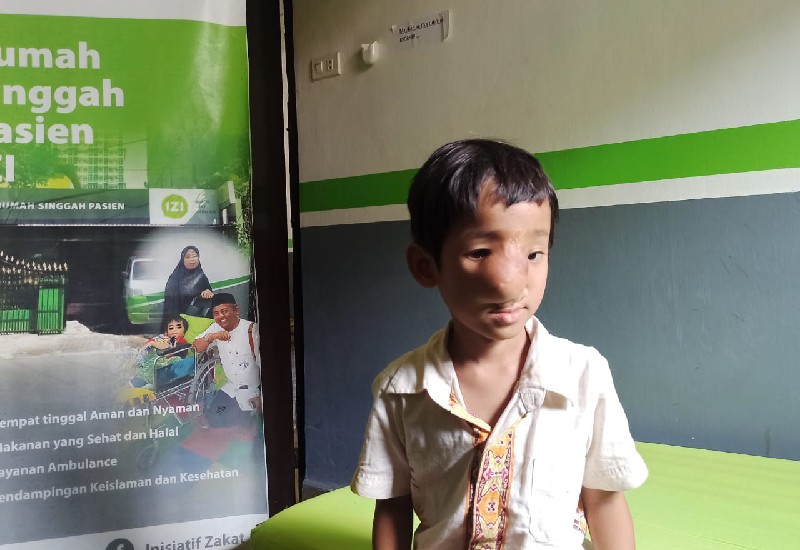  Mari Bantu Putra Agar Sembuh dan Tak Malu Sekolah