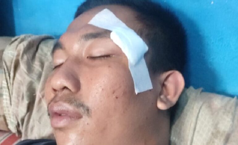  3 Kader HMI Komisariat Teknik Unila Jadi Korban Pengeroyokan