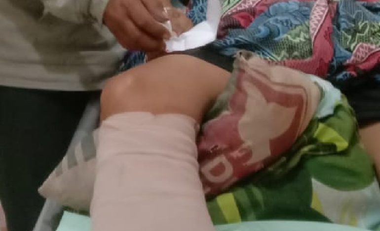  Kena Gergaji Mesin, Kaki Arip Warga Limau Tanggamus Diamputasi