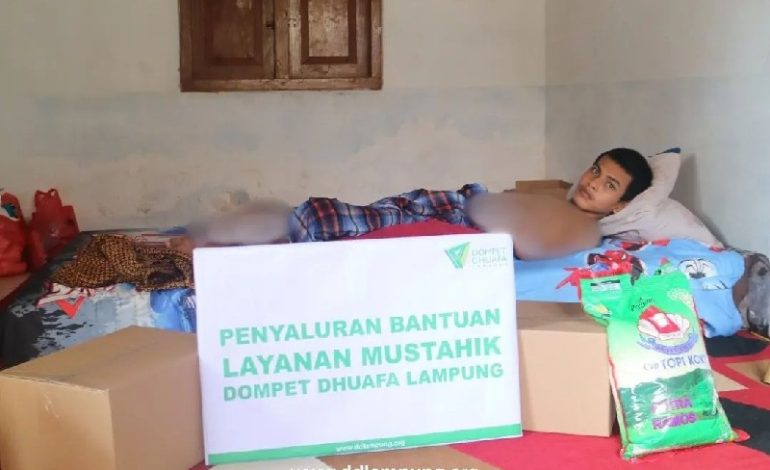  Dompet Dhuafa Lampung Bantu Gilang, Kaki Patah dan Saluran Pencernaan Rusak