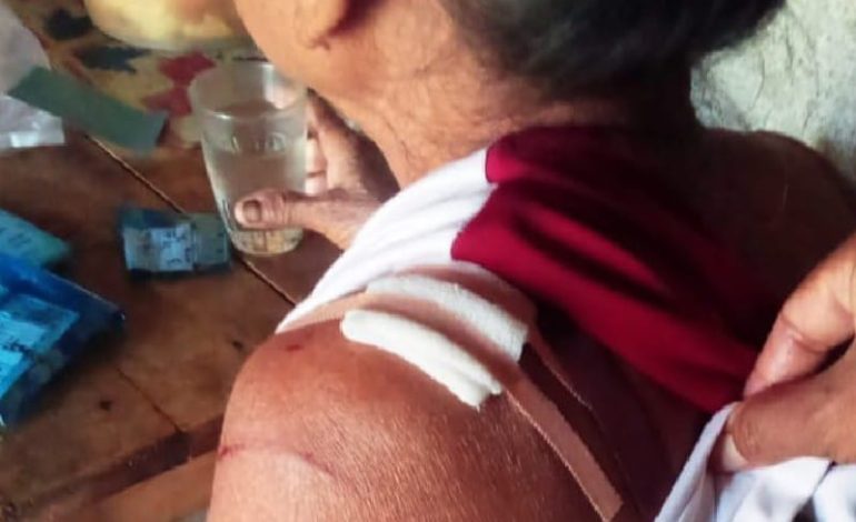  Diduga Diserang Buaya, Satu Warga Semaka Tanggamus Hilang, Satu Lainnya Terluka